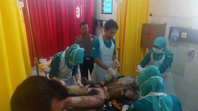 Ditinggal Kawin Pacar, Pria Ini Nekad Bakar Diri