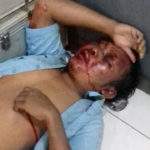 Sempat Kejaran-kejaran Di Pantura, Pencuri Mobil Ini Bonyok Lalu Ditangkap