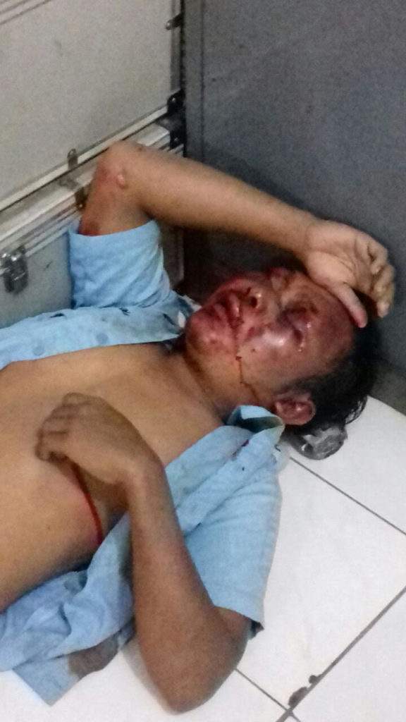 Sempat Kejaran-kejaran Di Pantura, Pencuri Mobil Ini Bonyok Lalu Ditangkap