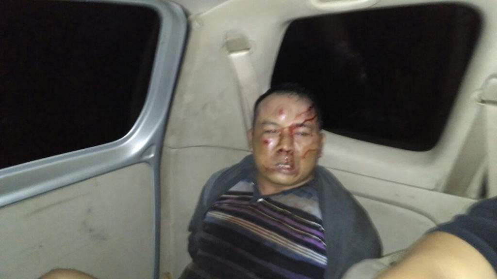 Gagal Maling Motor, "S" Babak Belur Dimassa