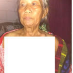 4 Tahun Mengidap Kanker Payudara, Warga Miskin Ini Belum Dapat Perhatian Pemda