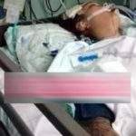 Alami Kecelakaan Bersama Temannya, Begini Kondisi Sheila Marcia