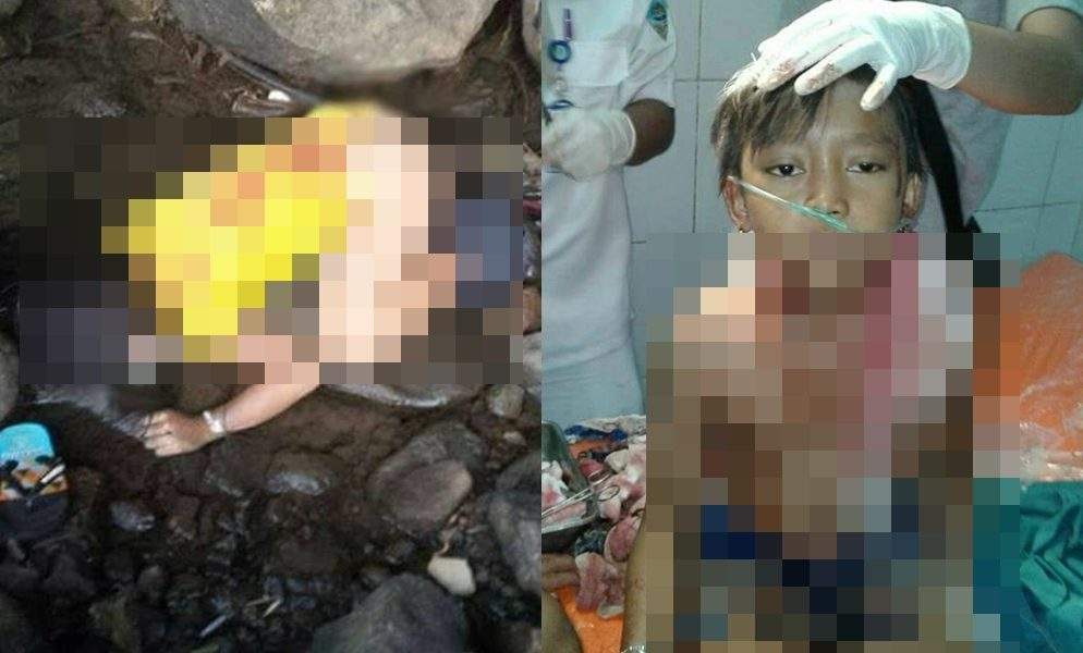 Saksi Korban di Sungai Ciloseh Dijaga Ketat Selama Pemulihan Saksi Korban di Sungai Ciloseh Dijaga Ketat Selama Pemulihan