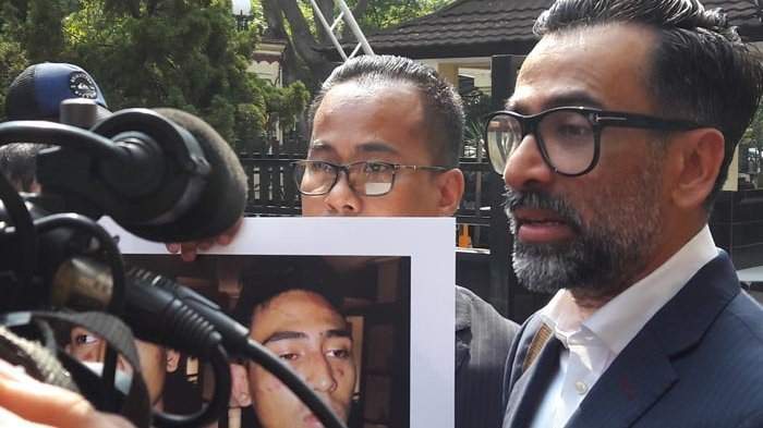 Dipaksa Ngaku Pake Narkoba, Anak Jeremy Thomas Bonyok di Tangan Polisi Dipaksa Ngaku Pake Narkoba, Anak Jeremy Thomas Bonyok di Tangan Polisi