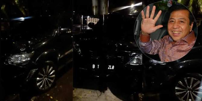 Duuuh..!! Setnov Ngakunya Kecelakaan, Sekarang Ada Di RS Permata Hijau