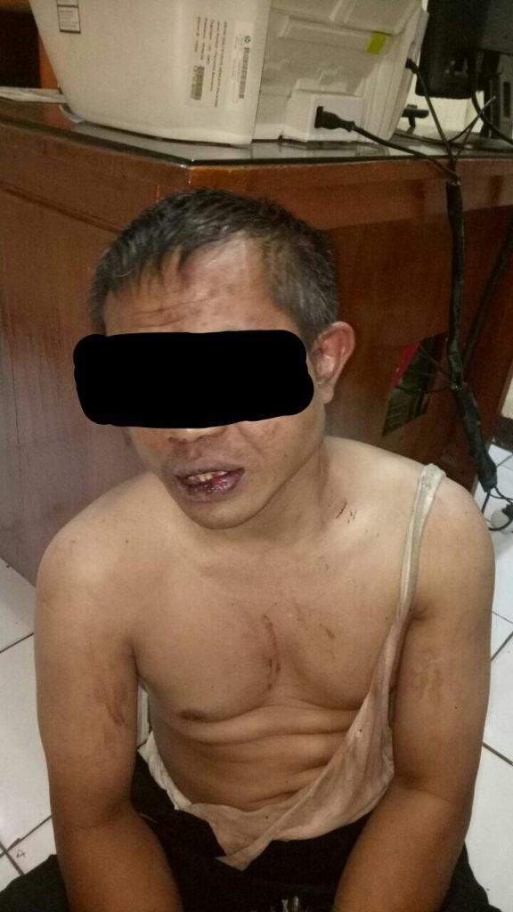 Karena Kepergok, Maling Aniaya Korban Hingga Babak Belur