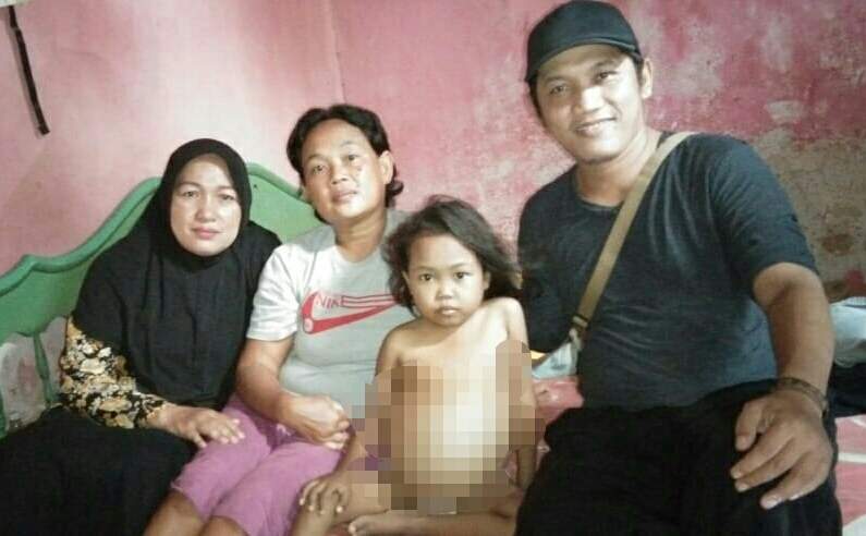 Butuh Bantuan, Bocah Asal Serang Wetan - Cirebon Derita "Thalasemia"