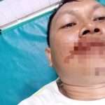 Seorang Wartawan di Cirebon Dianiaya Preman Kampung