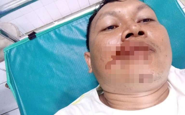 Seorang Wartawan di Cirebon Dianiaya Preman Kampung