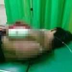 Mabuknya Rese! Seorang Pemuda di Gembongan Mekar Bacok Temannya