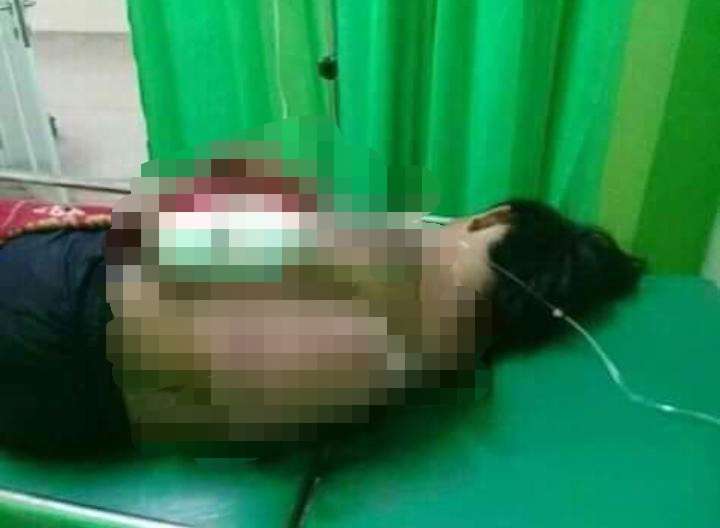 Mabuknya Rese! Seorang Pemuda di Gembongan Mekar Bacok Temannya