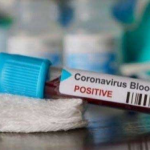 27 Tenaga Medis di Kota Bandung Terpapar Corona