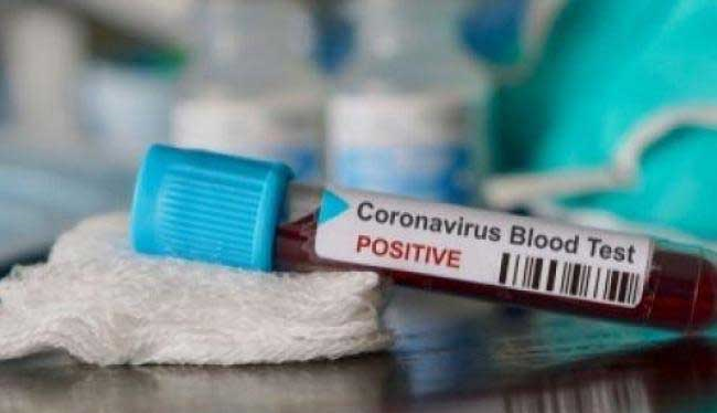 27 Tenaga Medis di Kota Bandung Terpapar Corona