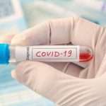 Mudik ke Kuningan dari Bekasi, Seorang Perantau Tularkan Corona kepada 11 Anggota Keluarganya