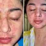 Sembuh Dari Covid, Kulit Dewi Perssik Jadi Begini