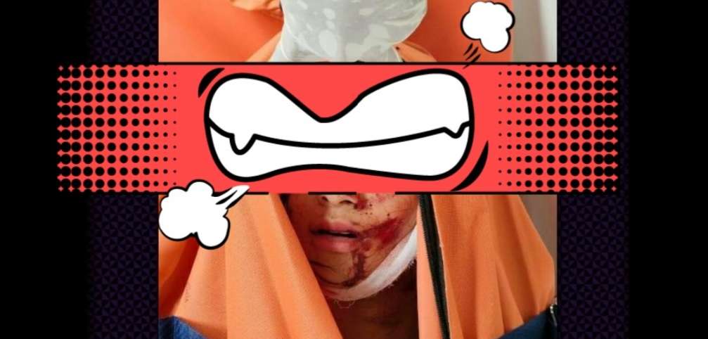 Vanessa Angel dan Suami Tewas Kecelakaan di Jombang Vanessa Angel dan Suami Tewas Kecelakaan di Jombang