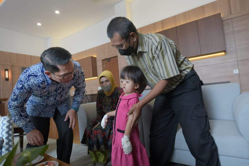 Balita Pengidap Apert Syndrom asal Rancaekek Dapat Bantuan Gubernur