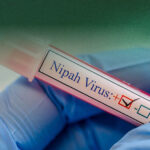 Virus Nipah