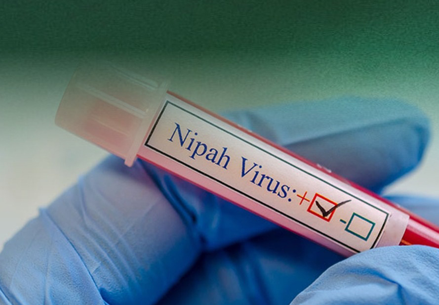 Virus Nipah