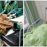 Anak kecil di Gembongan mekar tertusuk besi ulir