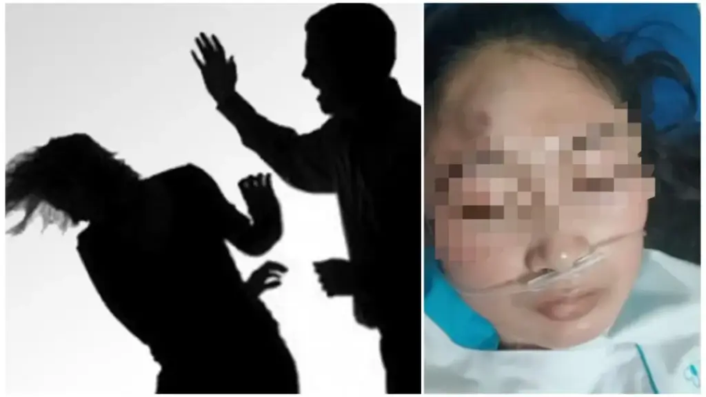Oknum Dokter Spesialis di Cirebon Diduga Aniaya Perawat Usai Cinta Ditolak, Korban Nyaris Pingsan