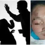 Oknum Dokter Spesialis di Cirebon Diduga Aniaya Perawat Usai Cinta Ditolak, Korban Nyaris Pingsan